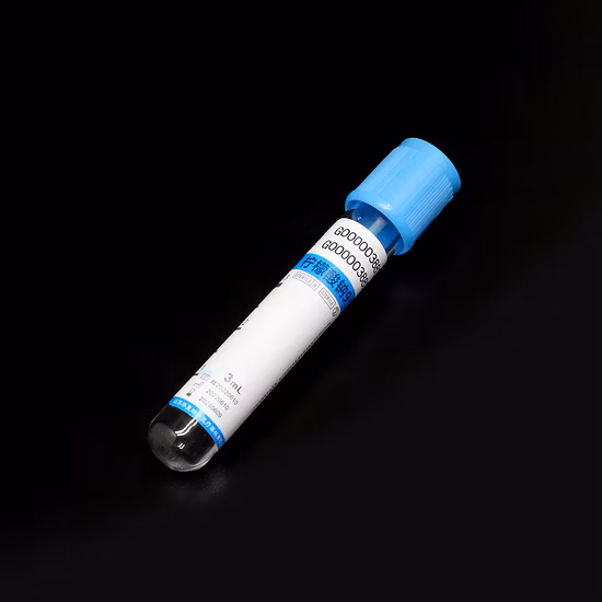 애완 동물/유리 4ml 6ml 플라스마 플라스틱 사출 성형 의료 기기 분리기 진공 혈관